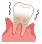 invisalign