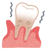 invisalign
